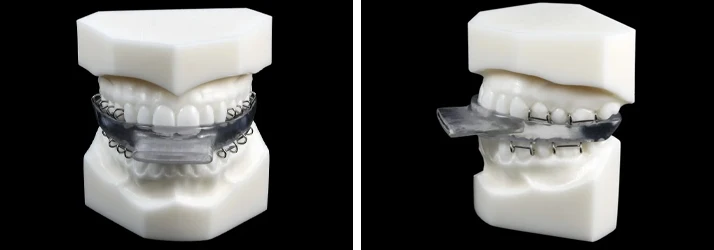 Sleep Apnea Treatment